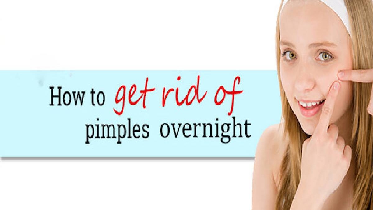 How to Get Rid of a Pimple Overnight? – Benzoyl Peroxide, Salicylic Acid, and More