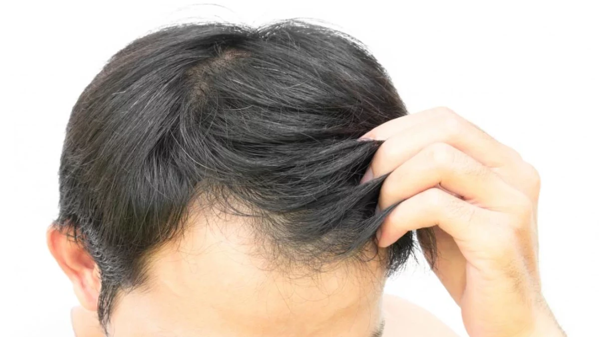 How to Stimulate Hair Growth? Top Hair Experts Talk